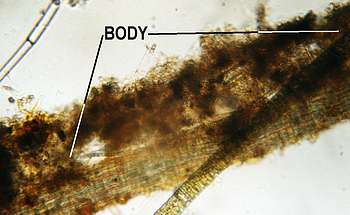 Cephalodella forficula in its tube