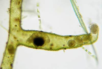 rotifer and eggs inside gall in Vaucheria filament