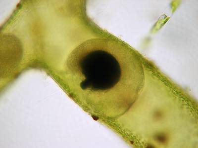 rotifer inside Vaucheria filament