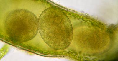 rotifer eggs inside Vaucheria filament