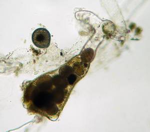 rotifer and eggs inside galled Vaucheria