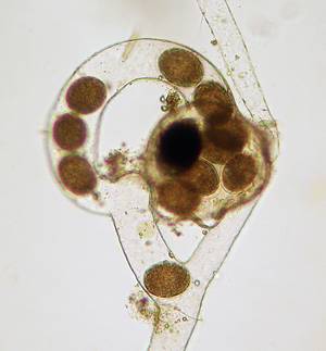 rotifer and eggs inside galled Vaucheria
