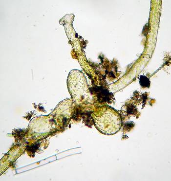 unusual growths on Vaucheria aversa