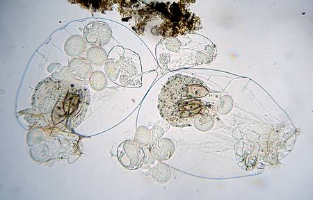Asplanchna with Keratella rotifers inside its stomach, and male above